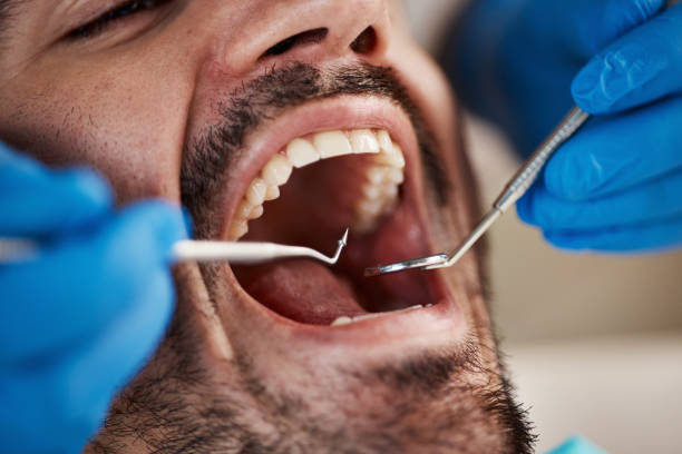 Oral Cancer Screening in Jackpot, NV